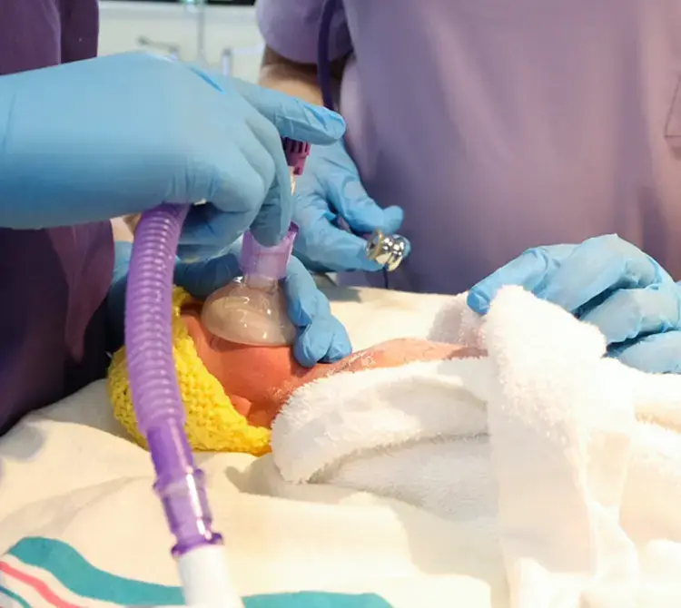 A neonate receiving respiratory care by two neonatal nurses
