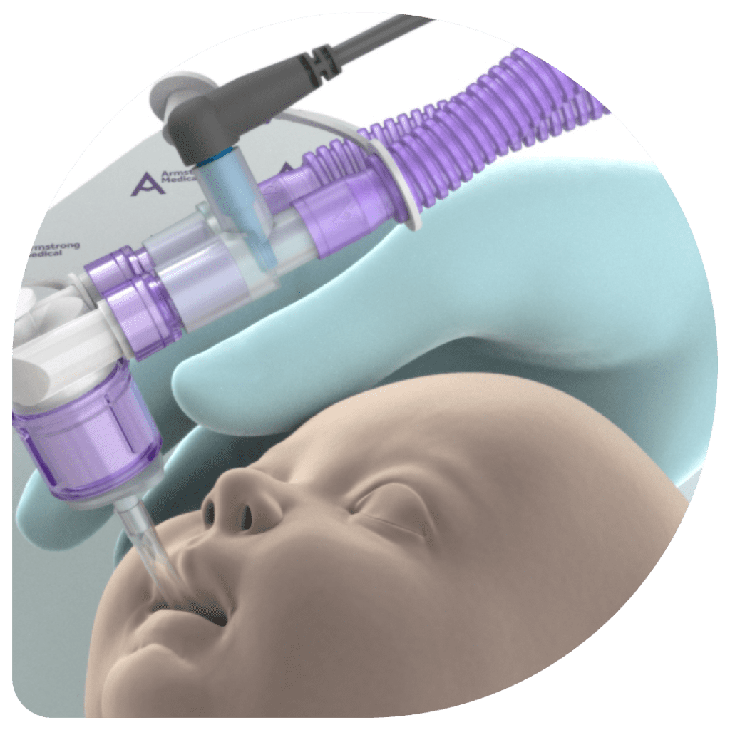 Computer generated image of a baby with Armstrong Medical Vapour Transmission device to show how gentle repositioning of infant results in minimal torque to the tracheal tube.