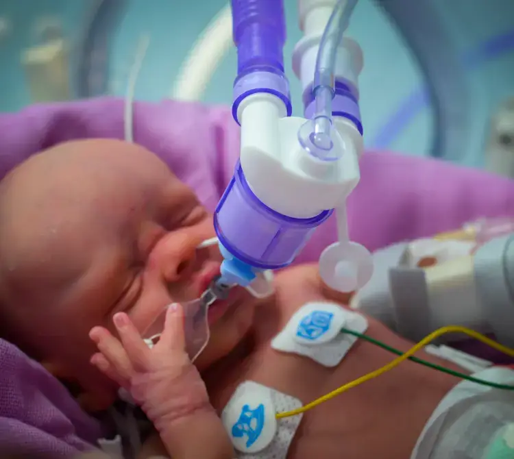Ogrzewane i nawilżane obwody NeoFlow® VT do respiratora dla noworodków
