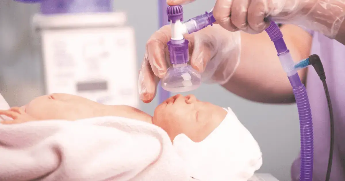 El papel de la reanimación humidificada con calor en la reducción de la hipotermia en bebés prematuros