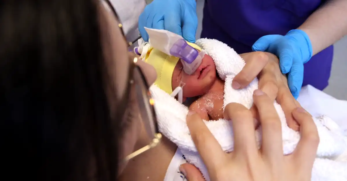 El contacto físico y los mimos en la sala de partos son posibles gracias a la CPAP